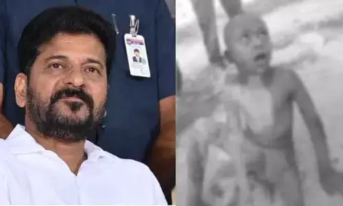 వీధి కుక్కల దాడిలో గాయపడిన బాలుడు.. స్పందించిన సీఎం రేవంత్‌రెడ్డి