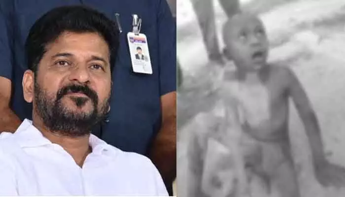 వీధి కుక్కల దాడిలో గాయపడిన బాలుడు.. స్పందించిన సీఎం రేవంత్రెడ్డి వీధి కుక్కల దాడిలో గాయపడిన బాలుడు.. స్పందించిన సీఎం రేవంత్రెడ్డి