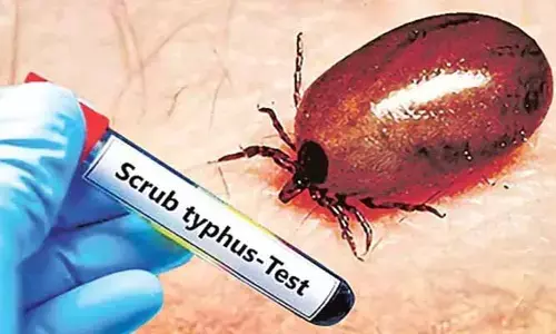 ఏపీలో నాలుగేళ్ళ చిన్నారికి స్క్రబ్ టైఫస్