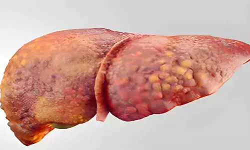 Fatty Liver : మ‌ద్యం సేవించ‌క‌పోయినా ఫ్యాటీ లివ‌ర్ స‌మ‌స్య వ‌స్తుంది.. ఎందుకో తెలుసా..?