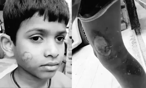 హైదరాబాద్‌లో దారుణం.. ఏడేళ్ల బాలుడిని అట్లకాడతో కాల్చిన ట్యూషన్ టీచర్