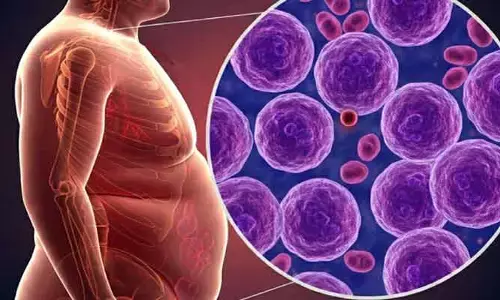 Health : ఊబకాయంతో క్యాన్సర్ రిస్క్..2035 నాటికి మరింత పెరిగే చాన్స్!