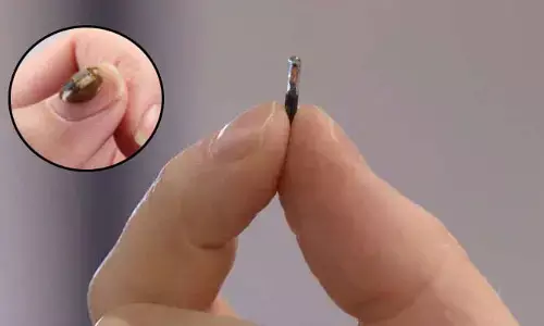 Technology : నియర్ ఫీల్డ్ మైక్రోచిప్స్.. అతి చిన్న సాంకేతిక పరికరాలదే భవిష్యత్తు అంటున్న నిపుణులు!