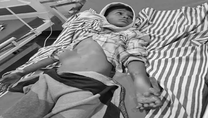 గాలి పటం కోసం వెళ్లి.. చిన్నారికి తీవ్ర గాయాలు గాలి పటం కోసం వెళ్లి.. చిన్నారికి తీవ్ర గాయాలు