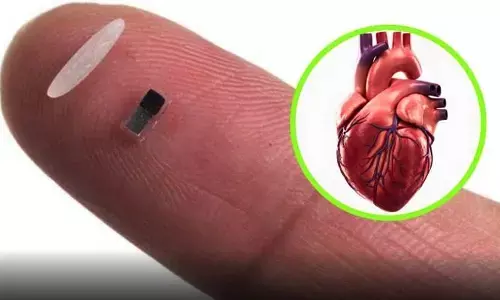 Medical Technology : గుండెకు ఢోకాలేదిక.. సర్జరీ తర్వాత రికవరీకోసం కొత్త సాంకేతికత!!