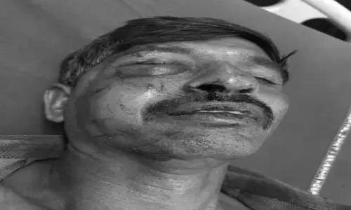 గీత కార్మికుడికి గాయాలు