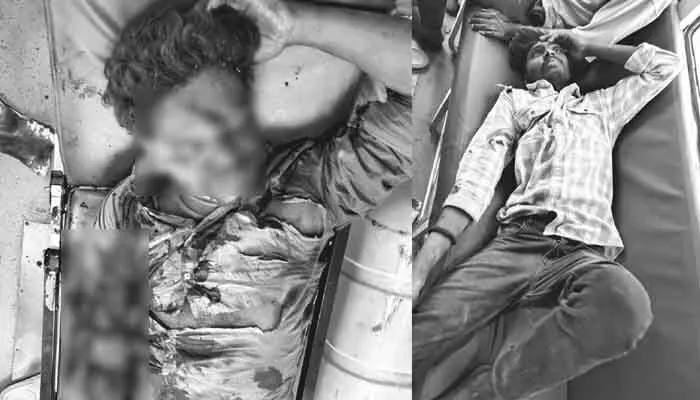 డివైడర్ ని ఢీ కొన్న బైకు.. ఒకరికీ తీవ్ర గాయాలు డివైడర్ ని ఢీ కొన్న బైకు.. ఒకరికీ తీవ్ర గాయాలు
