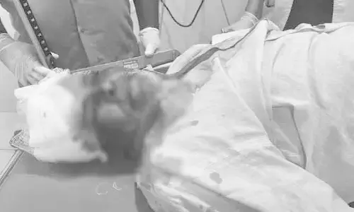 కారు ఢీకొని వృద్ధుడికి తీవ్ర గాయాలు