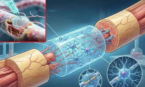 దెబ్బతిన్న నరాలను పునరుద్ధరించే ఇంజెక్టబుల్ జెల్.. MIT శాస్త్రవేత్తల ఆవిష్కరణ!