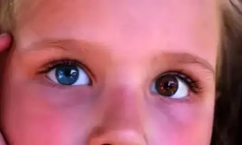 Eye health : కళ్లల్లో రెటినా రంగు మారడం.. ఆ వ్యాధి సంకేతమేనా?