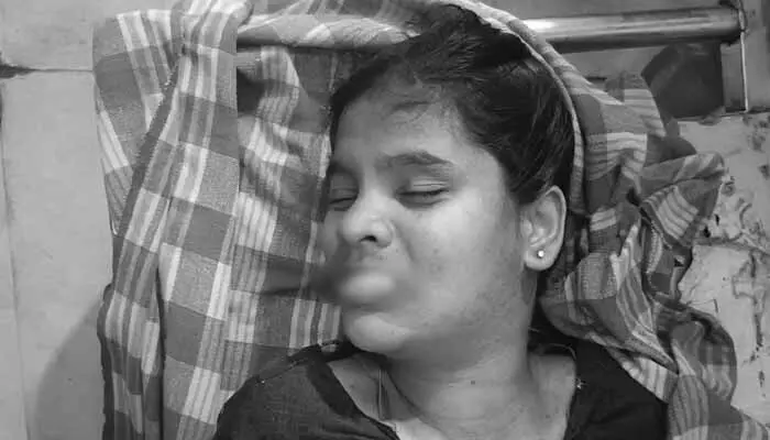 చికిత్స పొందుతూ యువతి మృతి