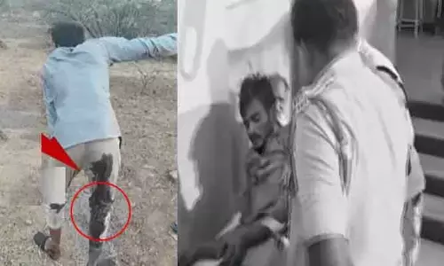 అనంతపురం బాలుడి హత్య కేసు.. నిందితుడిపై పోలీసులు కాల్పులు