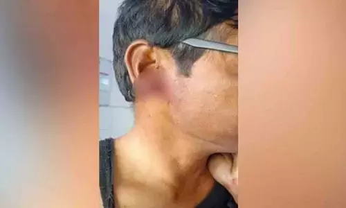 బాబాయి చెవి కొరికిన కొడుకు