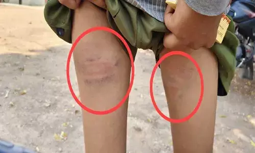 విద్యార్థుల‌ను చిత‌క‌బాదిన గురుకుల ప్రిన్సిపాల్