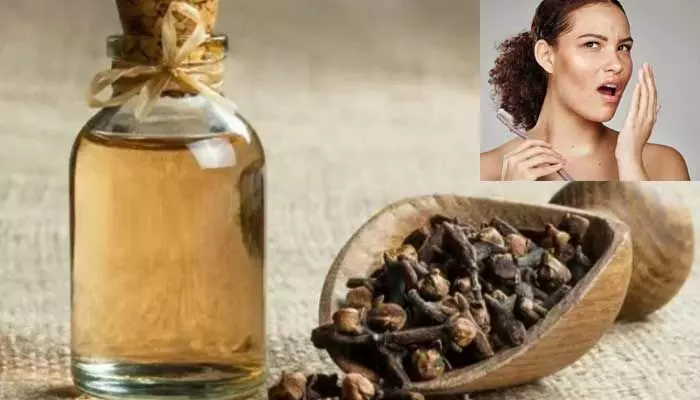 చిగుళ్ల నొప్పితో బాధపడుతన్నారా? లవంగం నూనెతో క్షణాల్లో పరార్ ! చిగుళ్ల నొప్పితో బాధపడుతన్నారా? లవంగం నూనెతో క్షణాల్లో పరార్ !