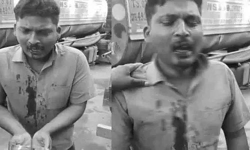 జలమండలి వాటర్ ట్యాంకర్ డ్రైవర్‌పై దాడి.. ముఖంపై తీవ్ర గాయాలు!