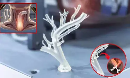 3D ప్రింటింగ్‌తో కృత్రిమ శ్వాసనాళం.. వైద్య రంగంలో మరో అద్భుతం!