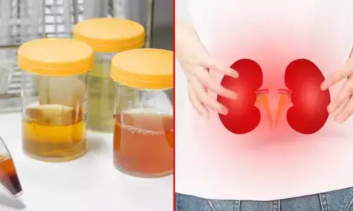 Health : యూరిన్ రంగు మారుతోందా..? కిడ్నీలు ప్రమాదంలో ఉన్నట్టే!!