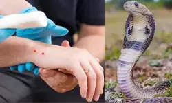 Snake bite : అసలే పాములు తిరుగాడే సీజన్.. బీ కేర్ఫుల్ ! Snake bite : అసలే పాములు తిరుగాడే సీజన్.. బీ కేర్ఫుల్ !