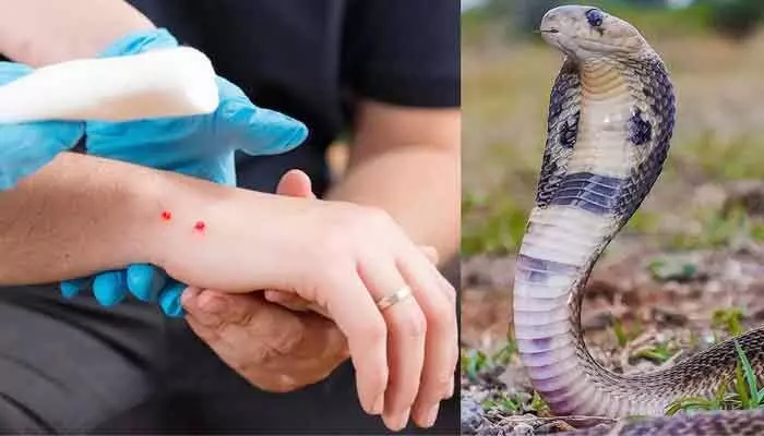 Snake bite : అసలే పాములు తిరుగాడే సీజన్.. బీ కేర్ఫుల్ ! Snake bite : అసలే పాములు తిరుగాడే సీజన్.. బీ కేర్ఫుల్ !