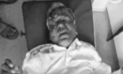 లారీ ఢీకొని వ్యక్తికి తీవ్ర గాయాలు.. పరిస్థితి విషమం లారీ ఢీకొని వ్యక్తికి తీవ్ర గాయాలు.. పరిస్థితి విషమం