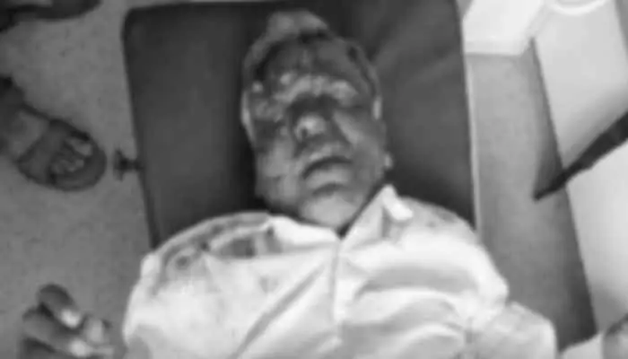 లారీ ఢీకొని వ్యక్తికి తీవ్ర గాయాలు.. పరిస్థితి విషమం లారీ ఢీకొని వ్యక్తికి తీవ్ర గాయాలు.. పరిస్థితి విషమం