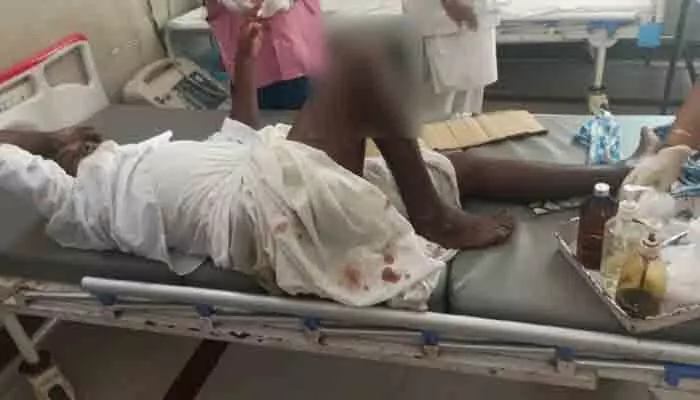 రోడ్డు ప్రమాదంలో ఒకరికి తీవ్ర గాయాలు రోడ్డు ప్రమాదంలో ఒకరికి తీవ్ర గాయాలు