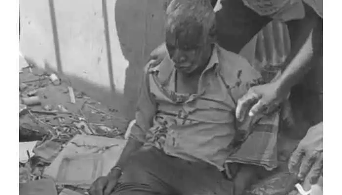 రోడ్డు విస్తరణ పనులు...చిరు వ్యాపారికి తీవ్ర గాయాలు రోడ్డు విస్తరణ పనులు...చిరు వ్యాపారికి తీవ్ర గాయాలు