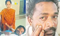 ఏపీలో మరో కస్టోడియల్ టార్చర్.. లాఠీలు విరిగేలా కొట్టారంటూ బాధితుడి ఆవేదన