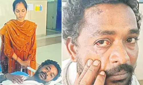 ఏపీలో మరో కస్టోడియల్ టార్చర్.. లాఠీలు విరిగేలా కొట్టారంటూ బాధితుడి ఆవేదన