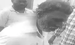కోతుల దాడిలో పలువురికి గాయాలు