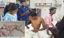 నాగర్‌కర్నూల్ జిల్లాలో పిచ్చికుక్క స్వైరవిహారం