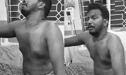 కోనసీమ జిల్లాలో ఘోరం.. భర్త పై యాసిడ్ పోసిన భార్య