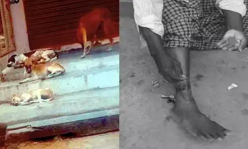 సదాశివపేటలో పెరుగుతున్న వీధి కుక్కల బెడద.. ప్రజల్లో ఆందోళన