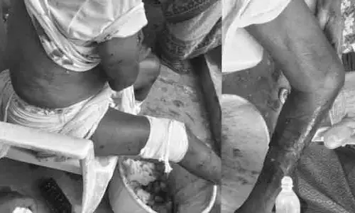 కోతుల దాడిలో వృద్ధుడికి తీవ్ర గాయాలు