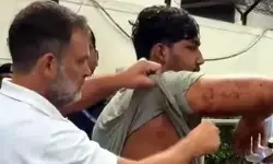 ఢిల్లీలో విద్యార్థులపై పెల్లెట్ గన్‌లతో దాడి.. కేంద్రంపై రెచ్చిపోయిన రాహుల్ గాంధీ
