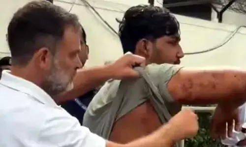 ఢిల్లీలో విద్యార్థులపై పెల్లెట్ గన్‌లతో దాడి.. కేంద్రంపై రెచ్చిపోయిన రాహుల్ గాంధీ