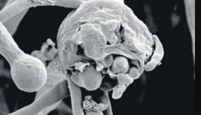 Black Fungus: బ్లాక్ ఫంగస్ అటాక్.. నవీపేట్‌లో మరో ఇద్దరు మృతి
