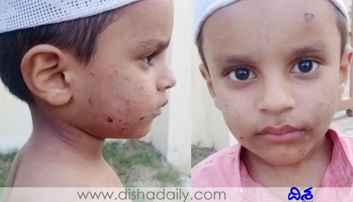 Madrasas attack, two children