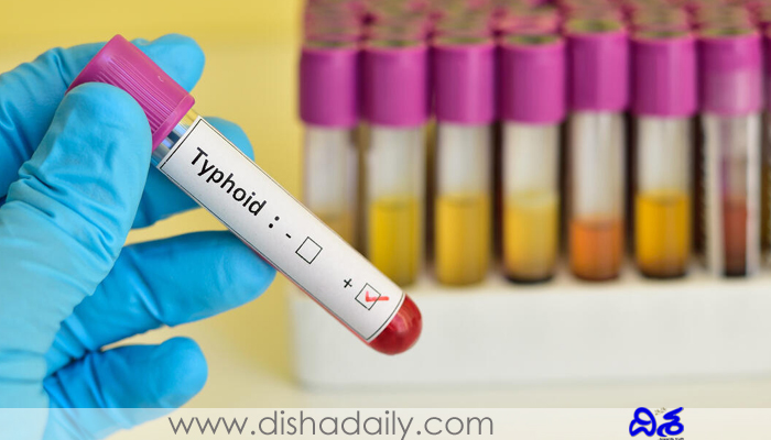 Typhoid tests